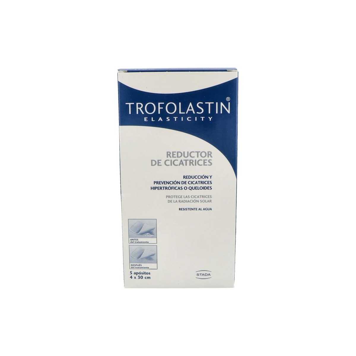 Carreras Trofolastin Re Cic 4X30 Cm 5 Un.